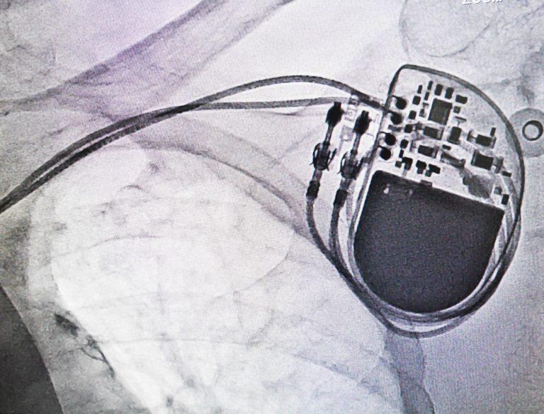 IoT Medical Device Fatal Flaw? Hackers Demonstrate New Attacks